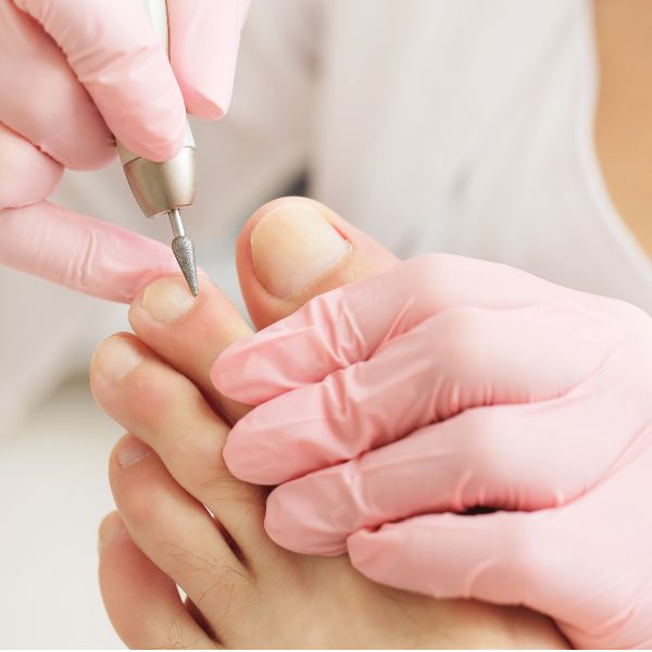 O profissional trata as unhas do pé de sua cliente para evitar fungos nas unhas.