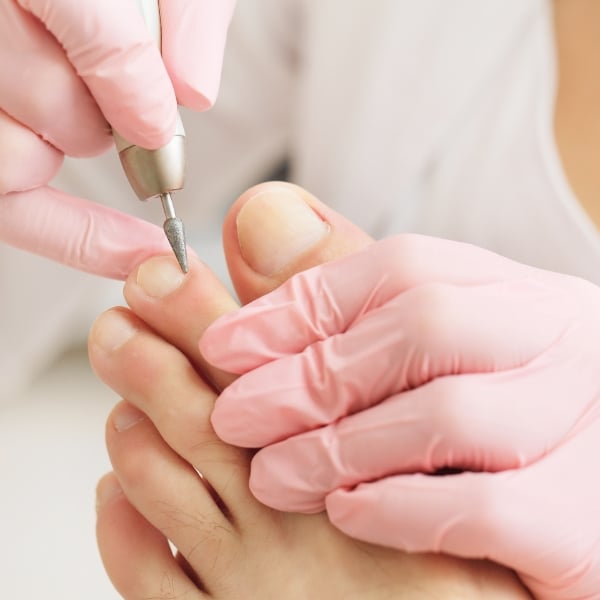 Profissional pedicure corta, lixa e realiza os cuidados para evitar a unha encravada.