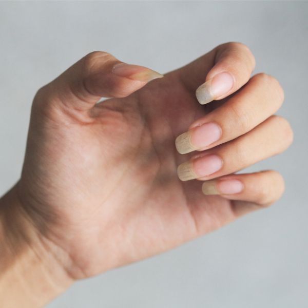 Uma mão com unhas naturais amareladas, sem esmalte, mostrando o estado antes ou depois da esmaltação.